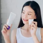 Best Skincare Products for Treating Acne that are Effective and Effective